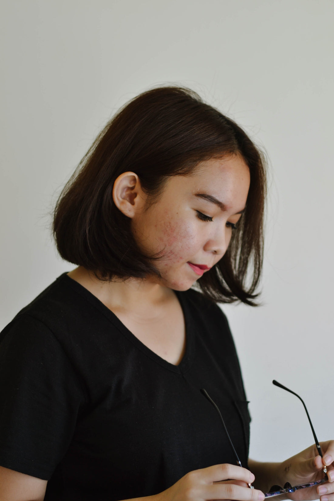 Acne, Psoriasis, Hemmorrhiods