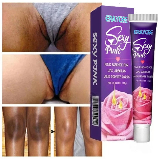 Brightening Cream For Intimate Parts Body Knees Remove Dull Pigments Brighten Serum Elbows Knuckles Lightening Skin Care Product