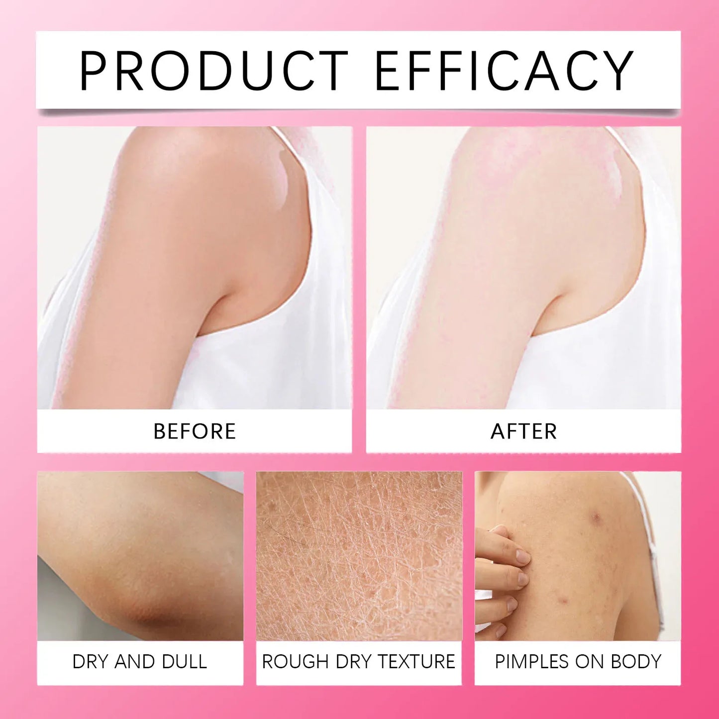 Whitening Body Cream For Dark Skin Armpit Thigh Inner Joint Fade Intimate Area Underarm Body Care Private Part Brighten Lotion